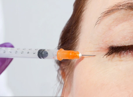 眼部特殊给药：玻璃体注射、视网膜下注射
